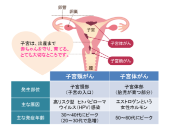 ん 子宮 体 ブログ が 子宮体がん 人気ブログランキングとブログ検索