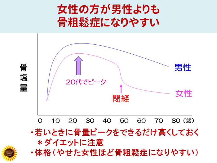 女性は男性よりも骨粗鬆症になりやすい