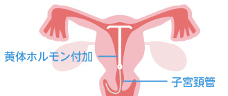 子宮