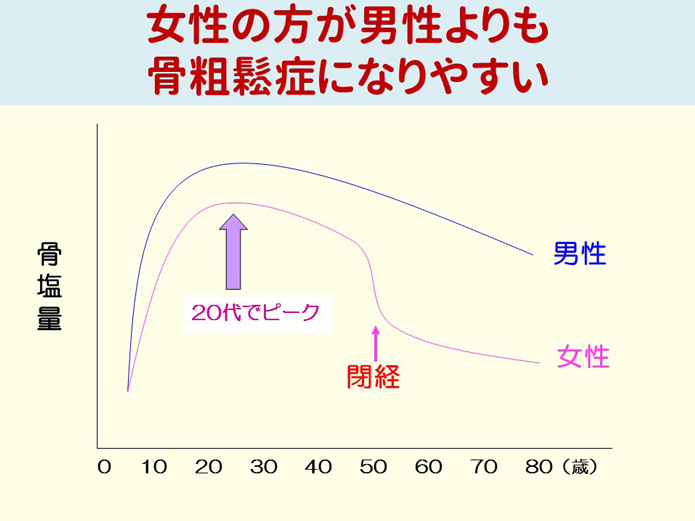 女性の方が男性よりも骨粗鬆症になりやすい