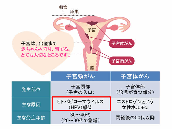 子宮は、出産まで赤ちゃんを守り、育てる、とても大切なところです。