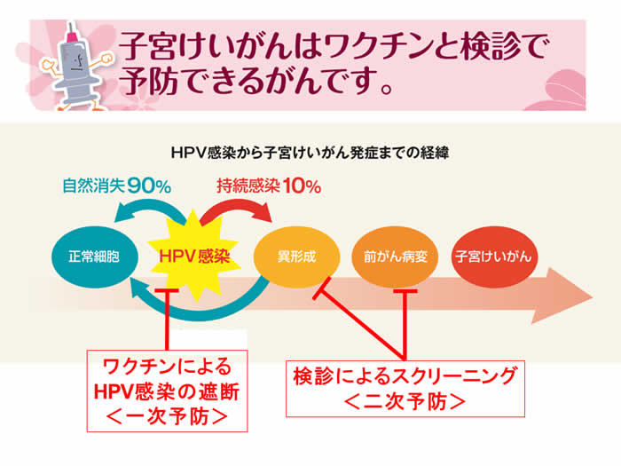 子宮けいがんはワクチンと検診で予防できるがんです。